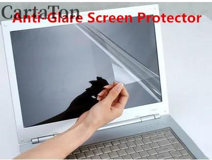 2PCS Anti-Glare reflection Mat - مراجعة Matte Anti Glare Screen وسعره