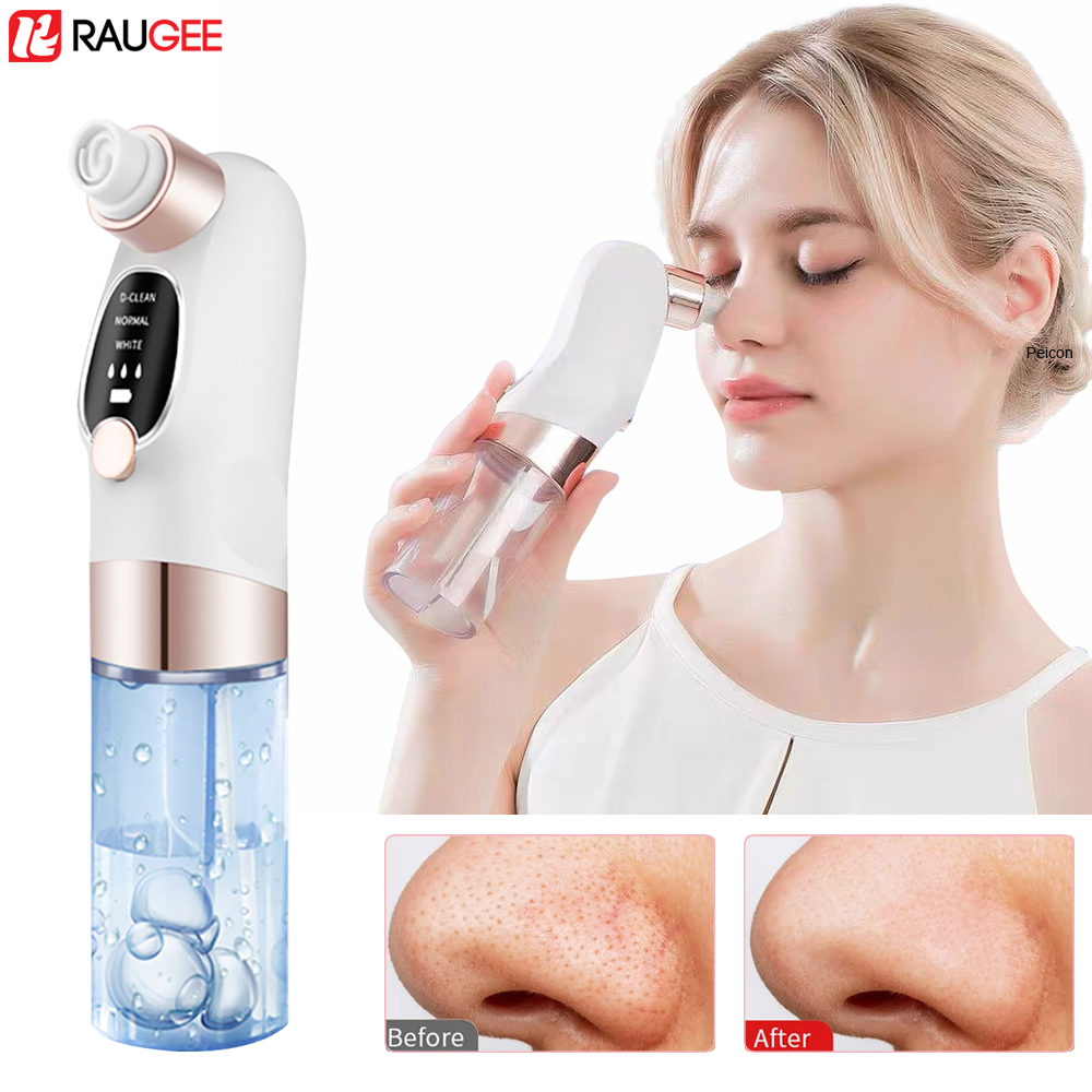Blackhead Remover Electric Bla - مراجعة Air Bubble Remover وسعره
