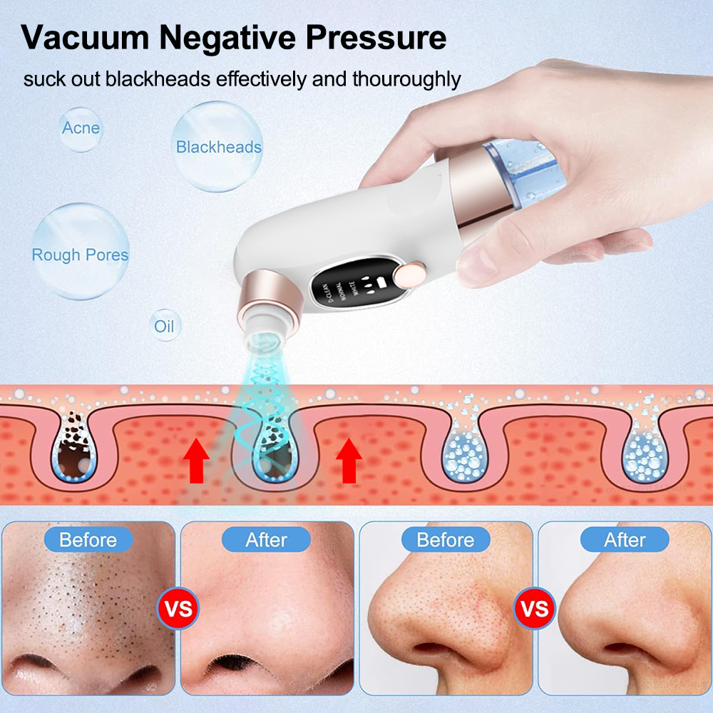 Blackhead Remover Electric Bla - مراجعة Air Bubble Remover وسعره